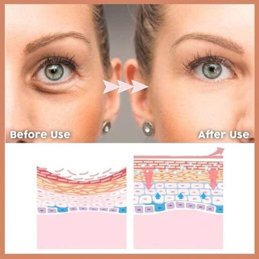 Eye Cream for Eye Bag Care