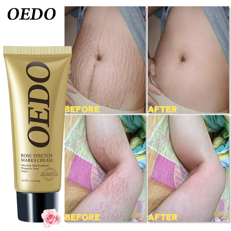OEDO Rose Stretch Marks Cream 40g tube with rose design packaging