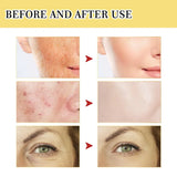 Bottle of Snail Collagen Power Repairing Liquid for skin repair and hydration